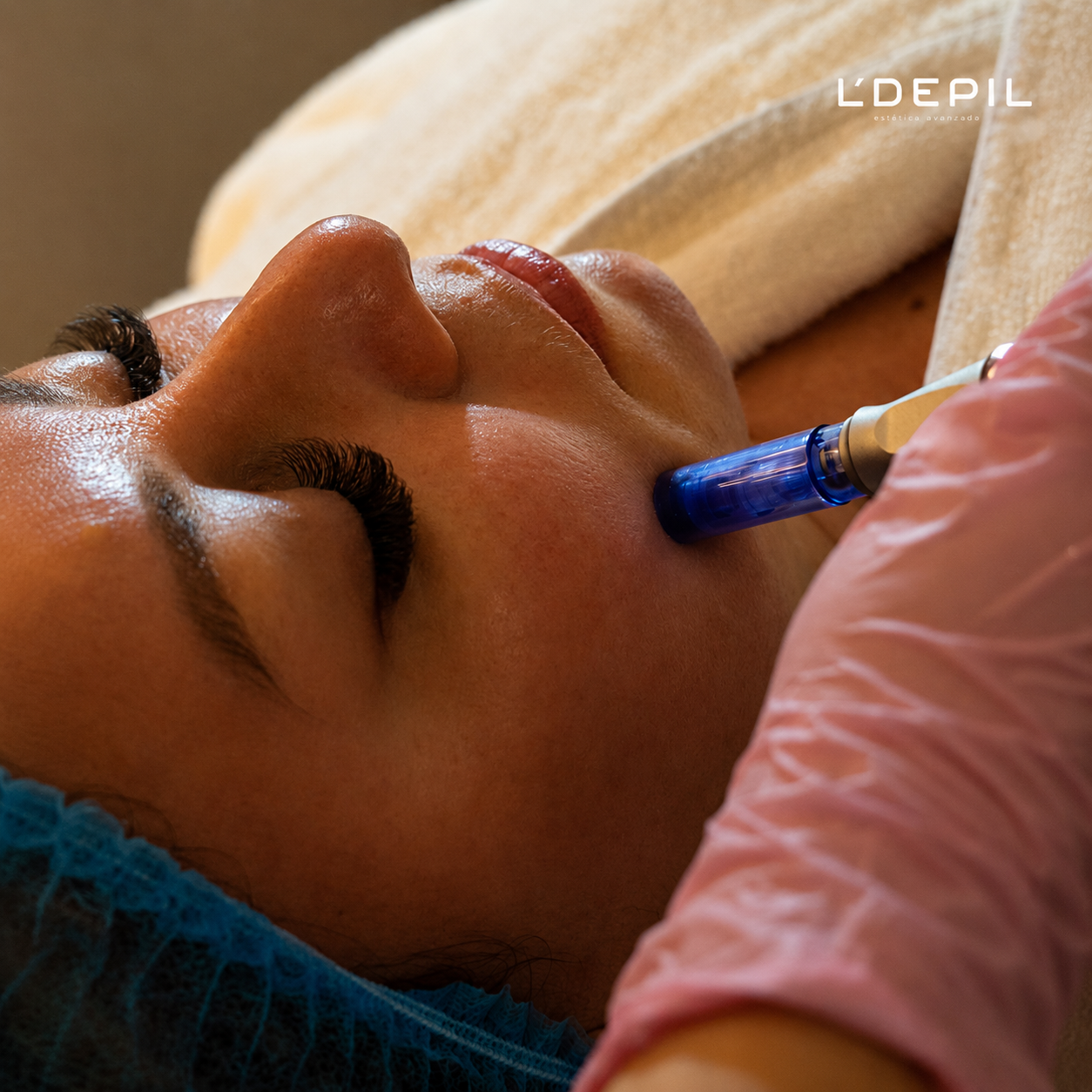 Facial